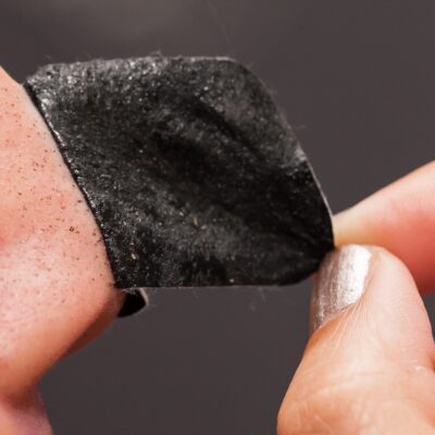 Blackhead: Strawberry Nose? Go Away!