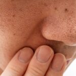 Pores: Can they be minimized?